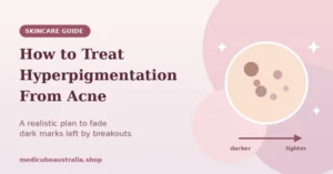 Skincare guide banner titled "How to Treat Hyperpigmentation From Acne" featuring an illustrative graphic of dark spots fading on skin against a soft pink background.